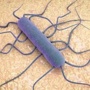 ¿Qué es la listeria y qué está pasando?